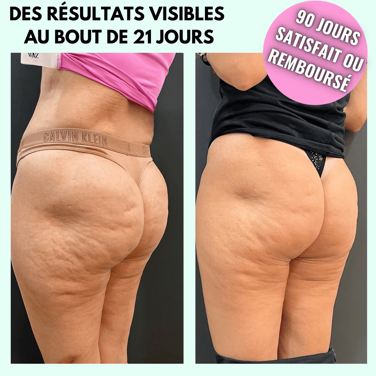 VIBRAPRO - Appareil Anti-Cellulite & Brûle-Graisse